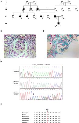 Case Report: A Novel Heterozygous Mutation of CD2AP in a Chinese Family With Proteinuria Leads to Focal Segmental Glomerulosclerosis